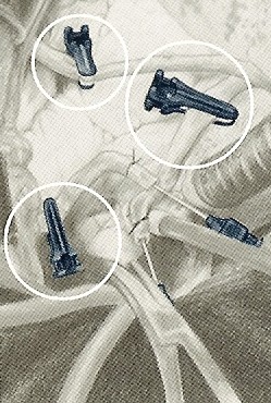 Voss Medical Products tweet media