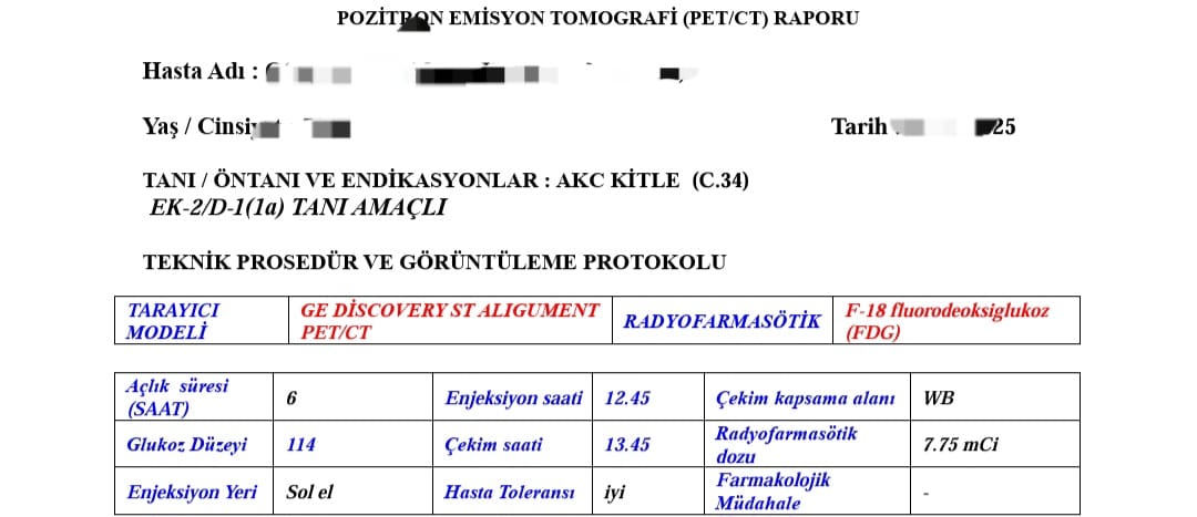 Bu Pkk'lı piçlerin beddua seansı yaptığı, ailesindeki kanser illeti ile savaşan Komandomuza omuz verelim.

İmkanı olanları desteğe çağırıyoruz.

TR47 0001 5001 5800 7321 3721 77  

Muharip ve İç Güvenlik Gazileri, Harp Malülleri ve Dul Yetimleri  Derneği 
Açıklama: Bağış Komando