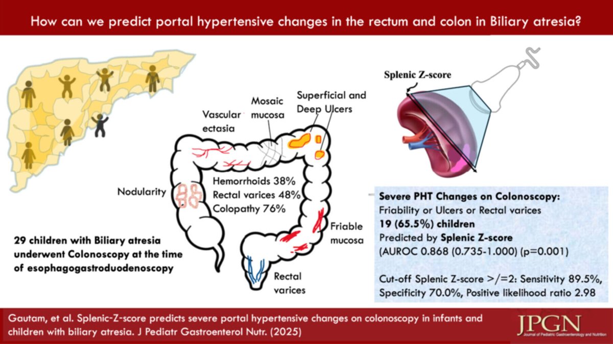 JPGNonline's tweet photo. In biliary atresia, severe portal hypertensive changes on colonoscopy were seen in 2/3 of kids 🩺
🔹 Splenic-Z-score strongly predicted these findings.
👉 https://t.co/ZEPbgEXAdv

#pediatrics #pedsgi #hepatology https://t.co/0syGD5CAcQ