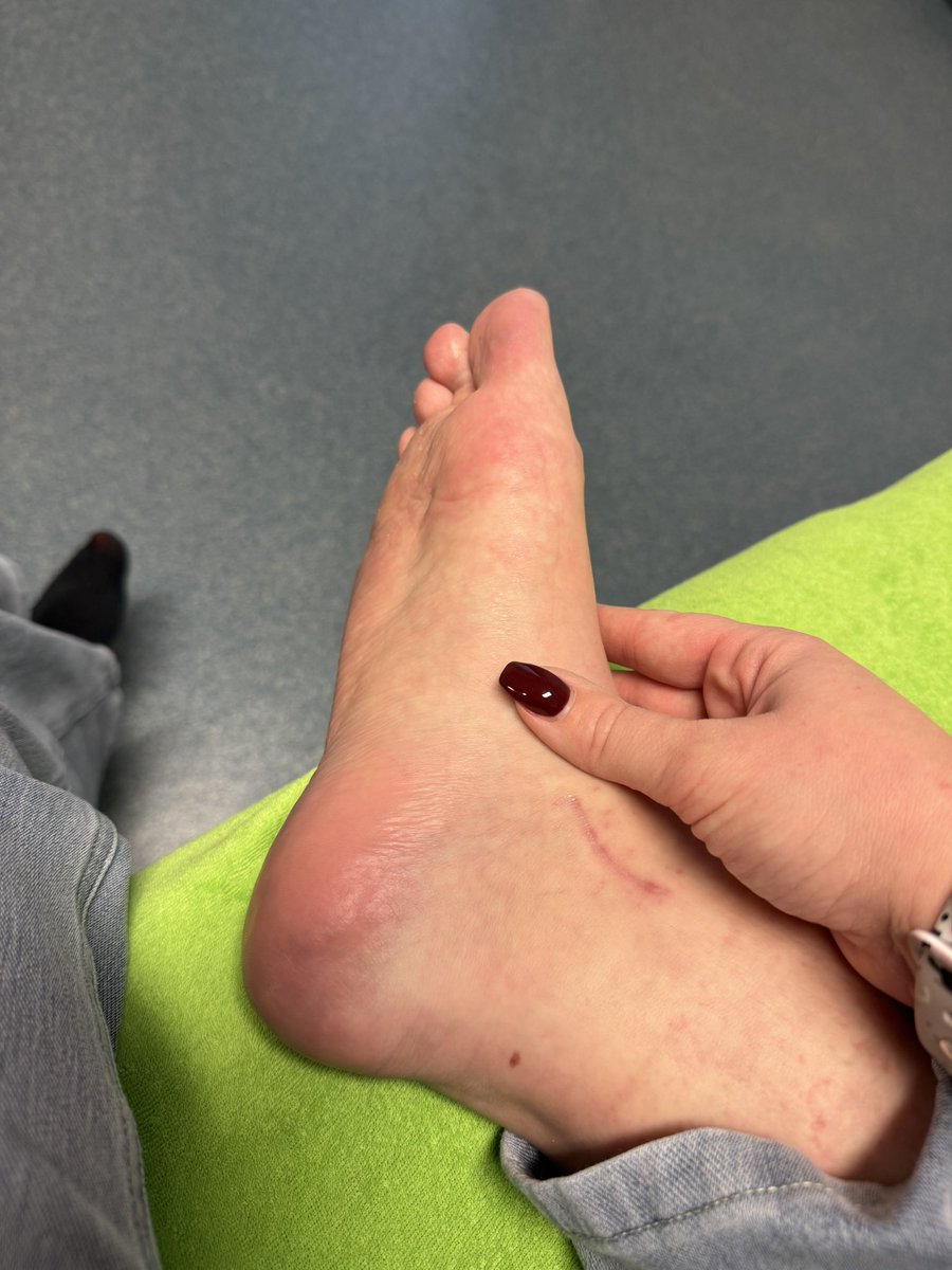 Luni_BB's tweet photo. Heute bei der Krankengymnastik, damit der Fuß auch wieder schick wird 🤫

#zahlschwein #paypig #geldsklave #geldherrin #zahlfotze #finsub #fetisch #subdom #feetfetısh #feet https://t.co/7SokxSH1Xk