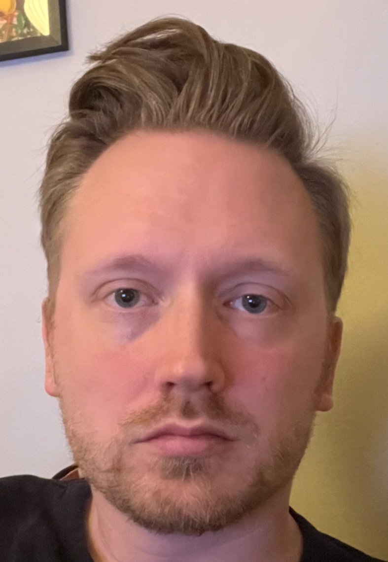 <a href="/SebMattz/">Sebastian Mattsson</a> Dude... "ögonen är själens fönster", sägs det. Dessa ögonen 👇signalerar en avgrund av total tomhet och självförakt. Du hade behövt en stor kram och någon slags mentor som hade kunnat coacha dig att bli att bli mindre vänsterbliven tror jag. Tror det hade gett dig gladare ögon.