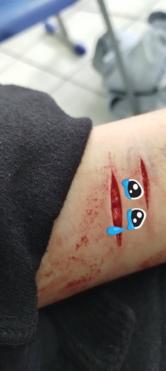 MNerdola52182's tweet photo. Bruh #gore #selfarm #shtなりきりさんがrtしてくれてそれを見たshtなりきりさんがきっとフォローしてくれる #shtwt https://t.co/ad1qzogBe4