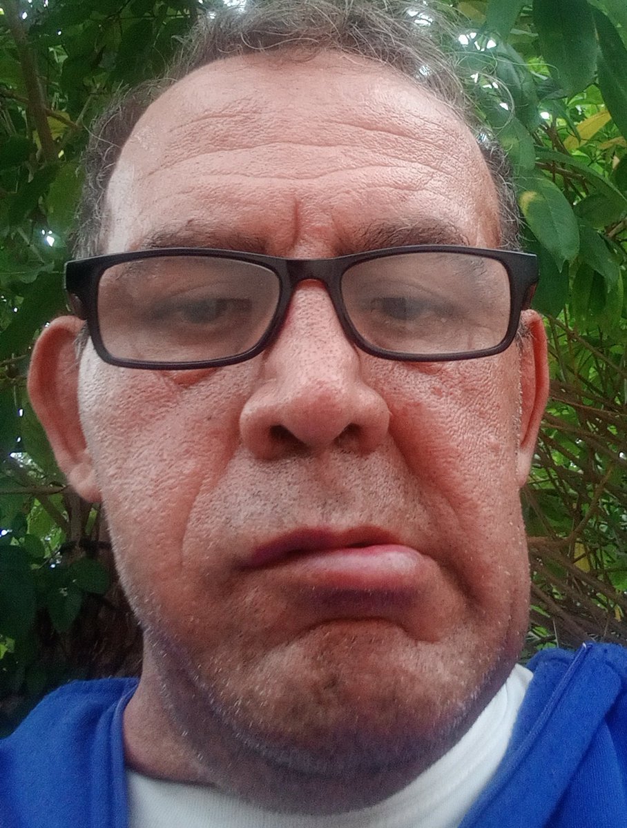 Me preguntan

¿Nacho qué tan mal estas?

Imagen mata cuento

Hace 15 días, estaba  yendo a buscar trabajo, con mi bastón

Hoy para moverme necesito ayuda, solo no puedo, sin diagnóstico y con  parálisis facial parcial.

Por eso, Ruego ayuda 🙏