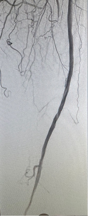 Robert A Lookstein MD, MHCDL tweet media