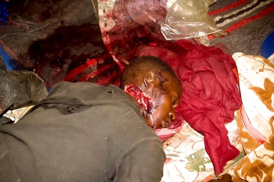 RuralEvangelist's tweet image. These are my people, my tribe, my kin who have been slaughtered in this manner, and yet some want us not to talk. 
There  aim to eradicate us entirely and take our land.😭😭😭