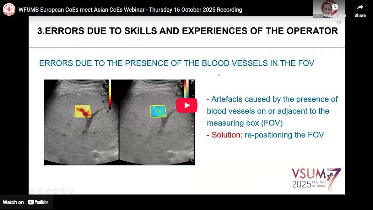 Did you miss yesterday's WFUMB European CoEs meet Asian CoEs Webinar?
Presentations from this events are already on the WFUMB website - take a look!
wfumb.org/2025/08/18/wfu…