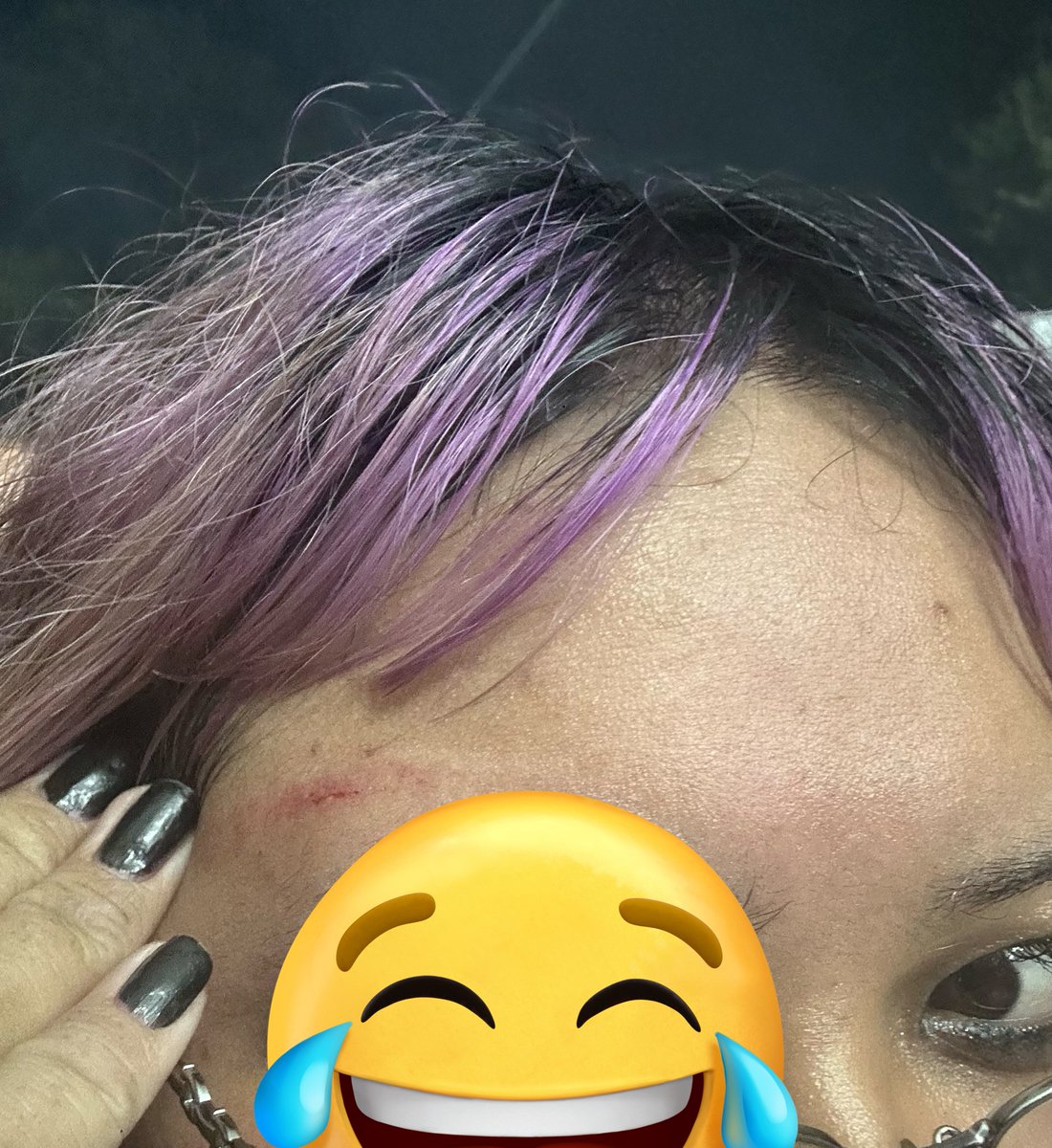 machngrI's tweet image. me after 2hollis threw his shirt and it landed on my head and everyone when crazy to grab it 😓 #ouch