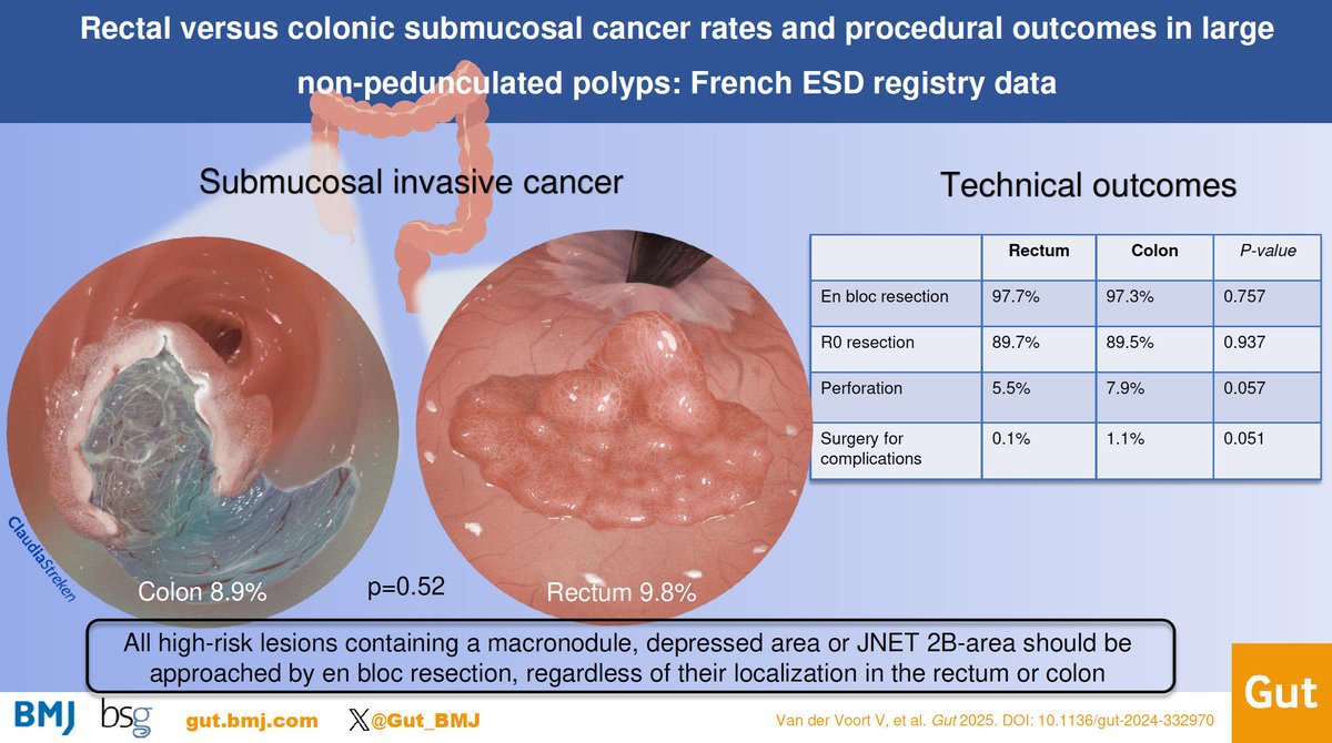 Gut_BMJ's tweet image. #GUTOnline paper by Van der Voort et al on

"Rectal versus colonic submucosal cancer rates and procedural outcomes in large non-pedunculated polyps: French ESD registry data" via

bit.ly/4oBy2cO

#ESD #Polyps
