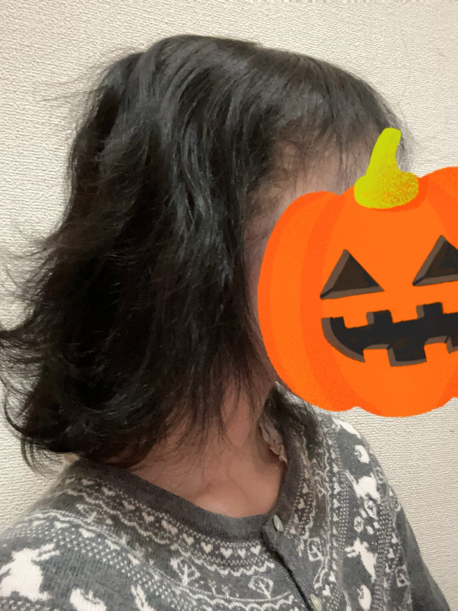最終抗癌剤投与日から約1年9ヶ月

相変わらず前髪とてっぺんが薄ーい
後ろは結構モフモフになった
でも髪質悪い…ツヤツヤではない