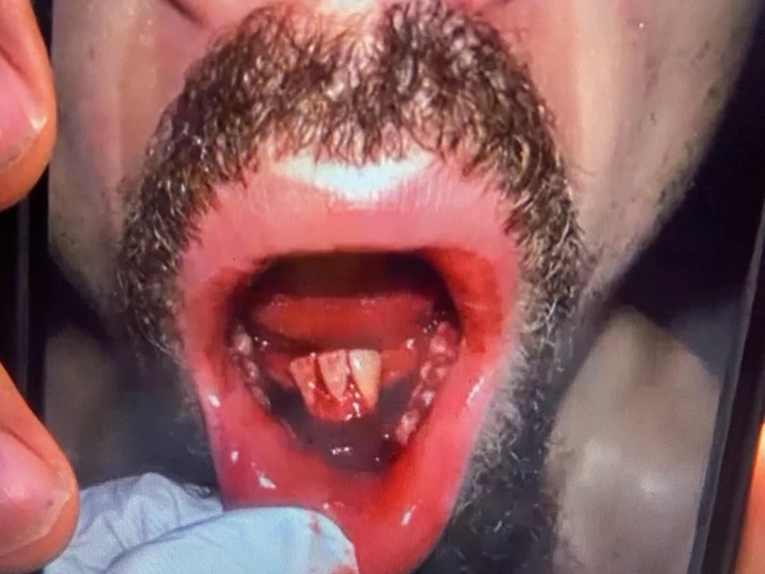 AFeldmanMMA tweet media