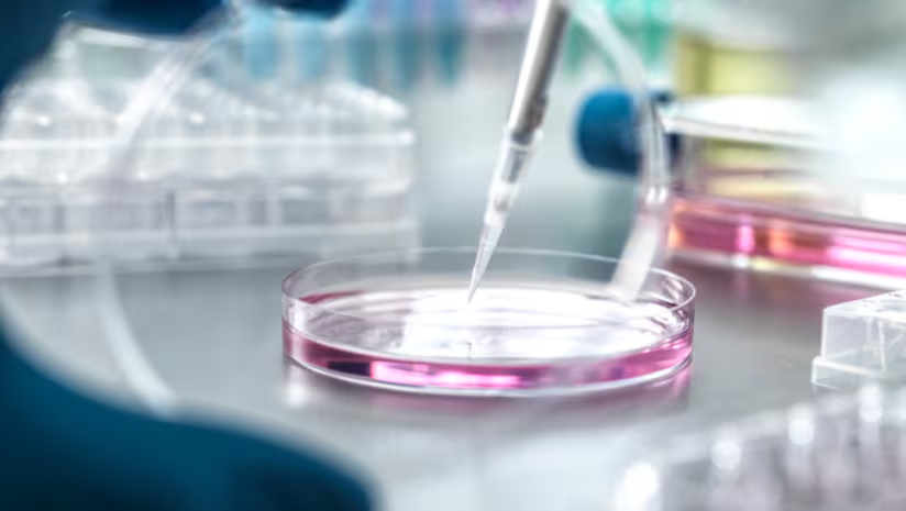 See new findings on collagen for wrinkles and knee pain reduction, nicotinamide mononucleotide's (NMN) reported benefits in increasing hair length growth at the anagen phase and more in this research news round-up.
#nmn #hair #collagen
nutraingredients.com/Article/2025/1…