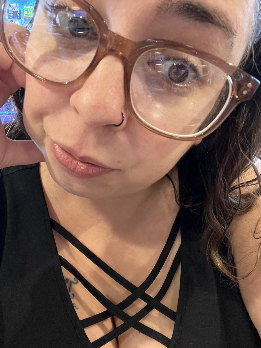 Iris_CU93's tweet image. Pues así seguimos… 😭 brote por toda la piel… 

#hidrosadenitissupurativa #hidrosadenitis #psoriasis #hiperhidrosis