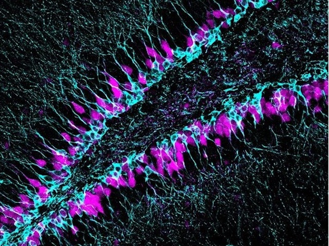 Sox5 gene controls neural stem cell activity ensuring balance between full quiescence &amp; being primed for action

📷 Cristina Medina-Menéndez, Paula Tirado-Melendro &amp; Lingling Li, et al <a href="/InstitutoCajal/">Centro de Neurociencias Cajal - CSIC</a> in <a href="/PLOSBiology/">PLOS Biology</a> 
➡️ bpod.org.uk/archive/2025/1… with <a href="/AntDLewis/">Ant Lewis</a>