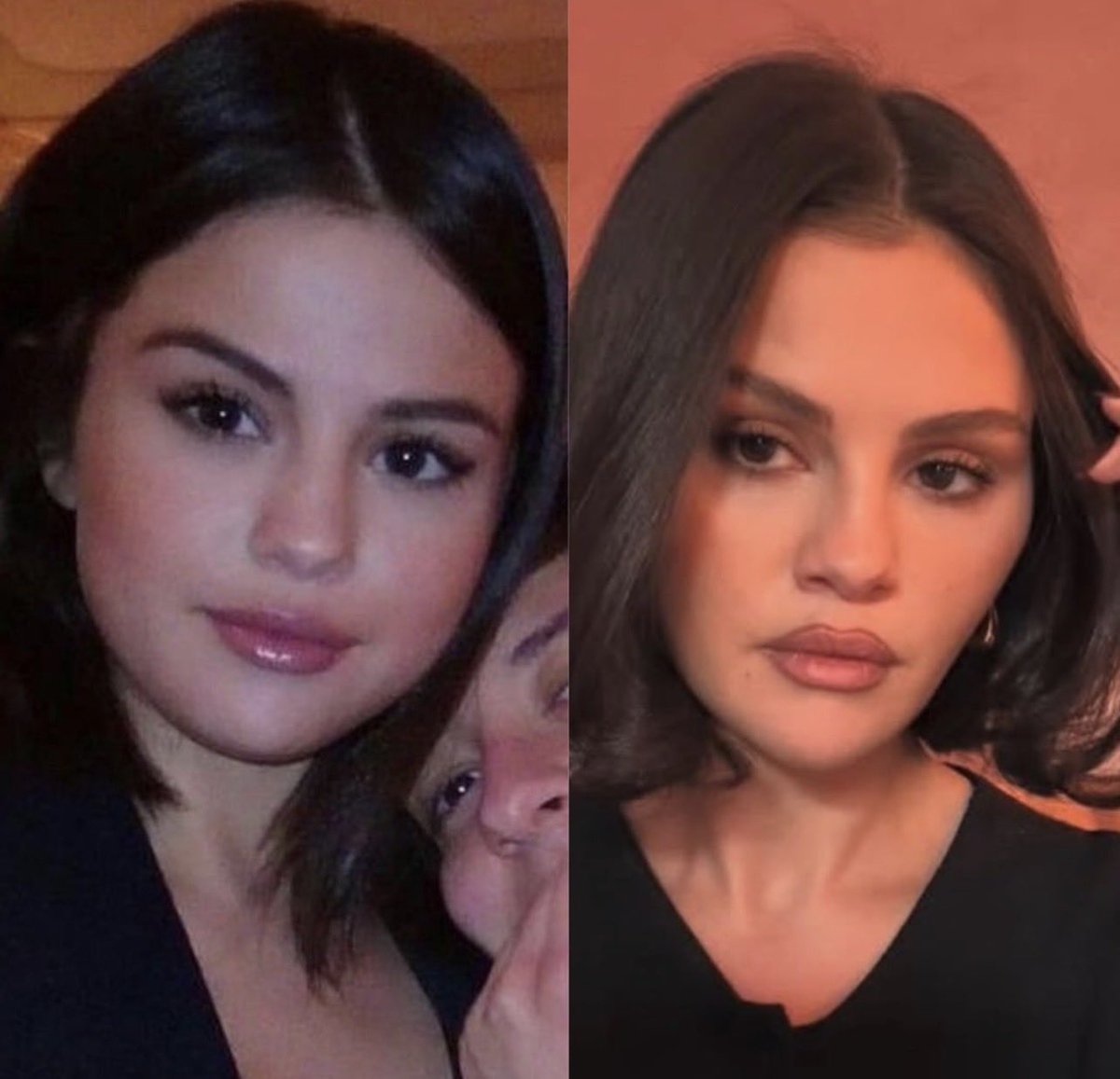 fawndollparts's tweet image. It’s not even about age cause these pics are only a few years apart, she sadly got convinced by her insecurities to remove a big chunk out of her cheek which threw the entire balance off her natural cute face… buccal fat removal should seriously be illegal