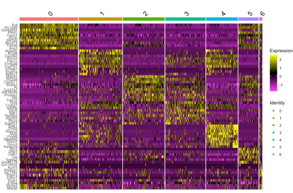 AJPathology's tweet image. #LegacyContent: Single-Nucleus RNA Sequencing Reveals Loss of Distal Convoluted Tubule 1 Renal Tubules in HIV Viral Protein R Transgenic Mice.
#OpenAccess text: ajp.amjpathol.org/article/S0002-…