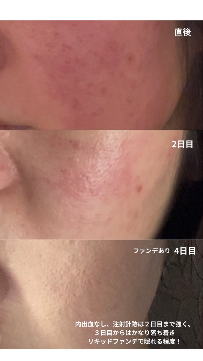 オラクル美容皮膚科【公式】 (@oracleclinic) / Posts / X