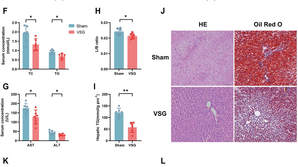 Microbial changes resulting from VSG attenuate #MASLD by modulating bile acid #metabolism and the intestinal FXR-FGF19 axis <a href="/mSystemsJ/">EIC Jack Gilbert</a> journals.asm.org/doi/10.1128/ms…