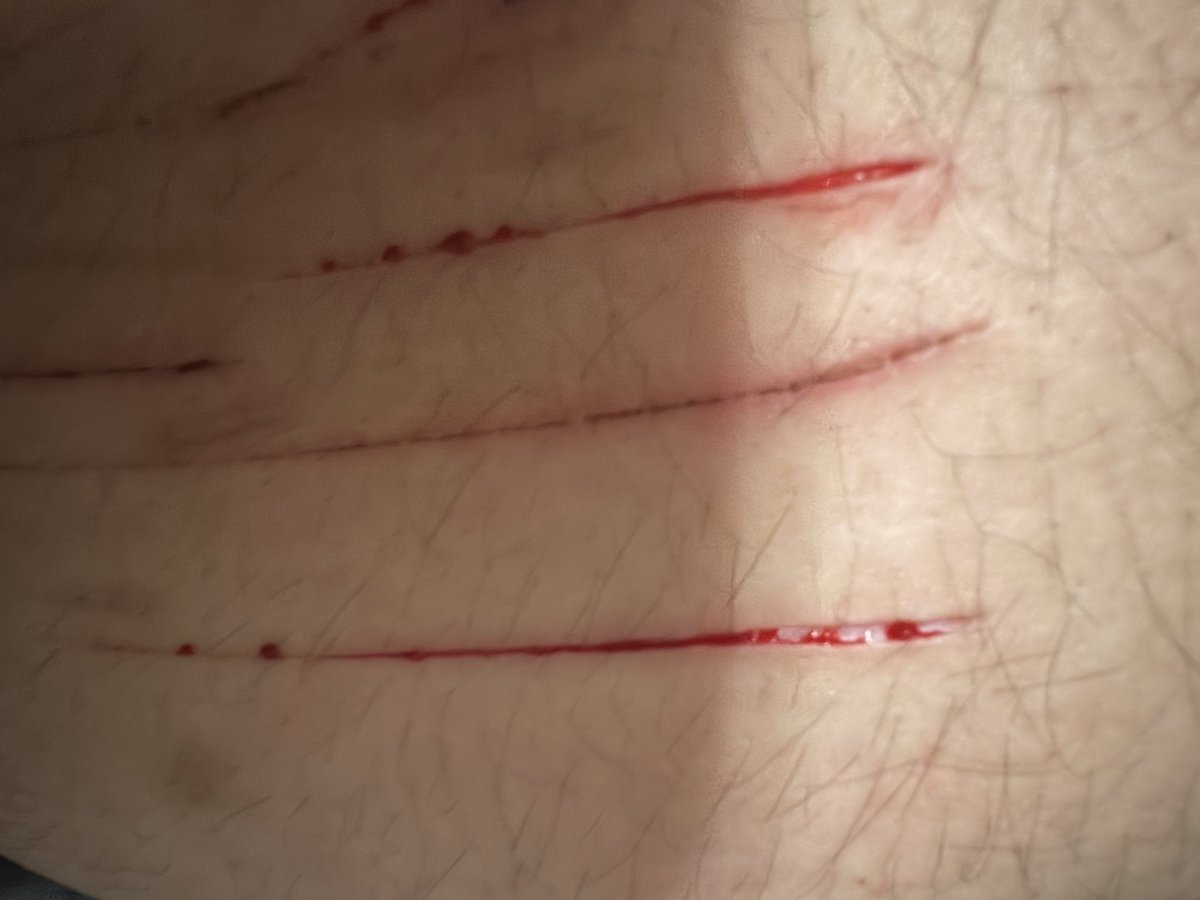 notsoviolent_'s tweet photo. TW CUTS
#shtwt #styro https://t.co/Zs3UJdIK2Q