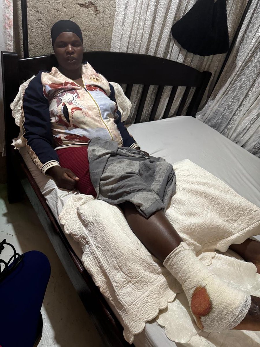 VOCALAfrica_'s tweet image. Linet Achieng’, a 36-year-old mother of four, was injured on her right leg during the tragic stampede at Kasarani Stadium while viewing the body of the late Hon. Raila Odinga. 
The chaos began shortly after police opened fire.
She is now in need of financial assistance to help…