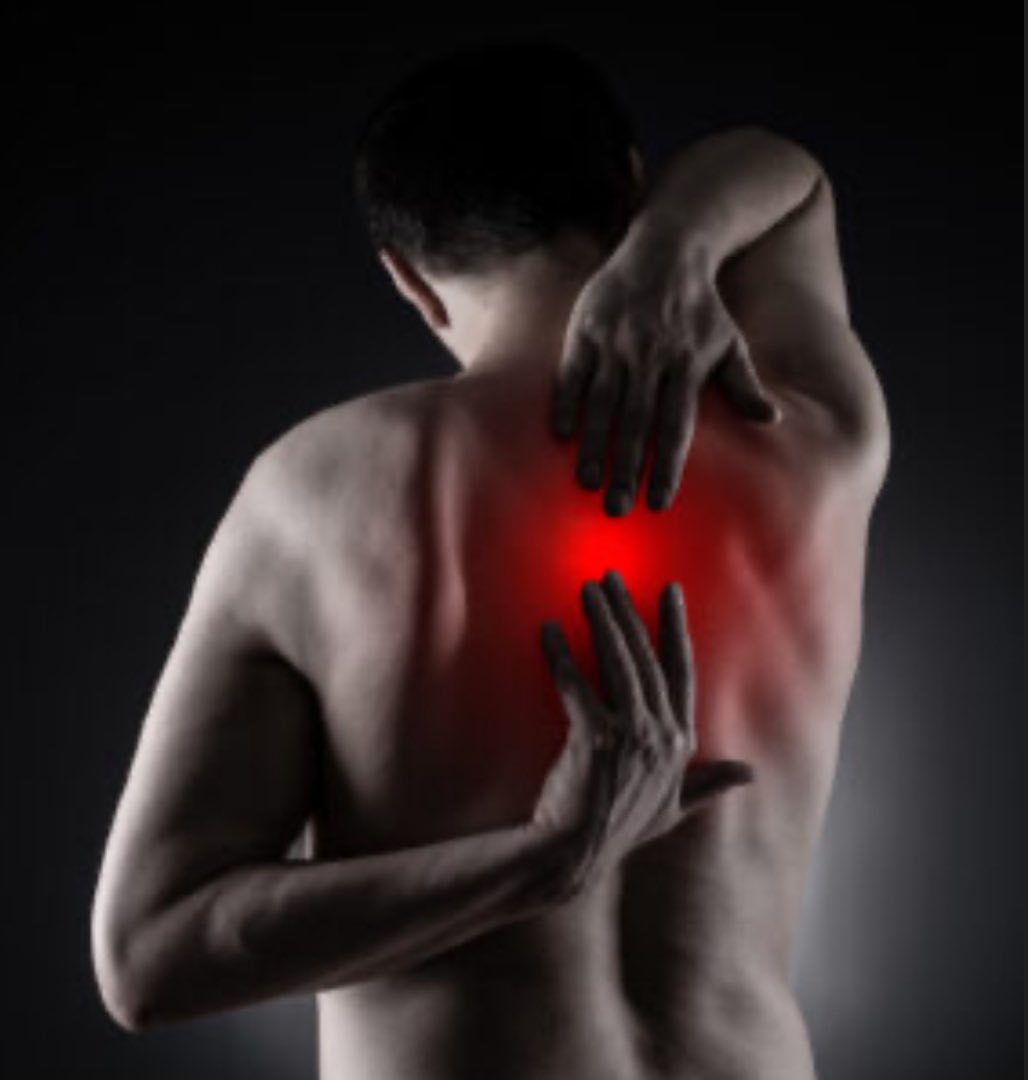 Alharbi__jana's tweet photo. Rhomboid Syndrome: حين يتحول الشد العضلي إلى ما نعرفه بإسم " الأبهر "

كثير من الناس يربطون أي ألم بين الكتفين أو بجانب العمود الفقري بكلمة “الأبهر”، لكن الحقيقة أن أغلب هذه الحالات تكون مرتبطة بعضلات rhomboid عضلتين صغيرتين تربطان لوح الكتف بالعمود الفقري، ودورهما الحفاظ على ثبات الكتف أثناء الحركة.
وعندما تتشنج أو تُجهد هذه العضلات، تبدأ الأعراض التي نعرفها جيدًا:
ألم حارق أو طاعن بين الكتفين، شعور بثقل أو شدّ، وأحيانًا يمتد الألم إلى الكتف أو الصدر.

🧠 وش الأسباب اللي تخلي العضلة تتشنج؟

��لسبب الأكثر شيوعًا هو التحميل الزائد أو الوضعيات الخاطئة، خصوصًا:
•الجلوس لفترات طويلة بانحناء للأمام (أمام اللابتوب أو الجوال).
•ضعف عضلات الظهر العلوية مع شدّ مفرط في عضلات الصدر.
•حركات سحب متكررة أو حمل أوزان بطريقة خاطئة.
•وحتى التوتر النفسي المستمر ممكن يسبب شدّ عضلي مزمن في نفس المنطقة.

ومع الوقت، يصير الألم مزمن بسبب ضعف توازن العضلات بين الأمام والخلف — يسمّى هذا muscle imbalance، ويعتبر أحد الأسباب الرئيسية في استمرار الألم.

وش يميز ألم الـ Rhomboid عن مشاكل ثانية؟
•الألم عادة مو عميق داخل الصدر مثل مشاكل القلب، بل محدد بجانب لوح الكتف.
•يزداد مع الح��كة أو الجهد وليس في الراحة.
•ممكن تحسّ بنقطة “عقدة عضلية” أو Trigger point إذا ضغطت عليها.
•ممكن يخف الألم مؤقتًا ، لكنه يرجع إذا ما تعالج السبب الأساسي.

⚕️ دور العلاج الطبيعي:

العلاج هنا ما يعتمد فقط على فكّ الشد، بل على تصحيح السبب اللي خلا العضلة تتعب من الأساس.
ويتضمن:
•تحرير العضلات يدويًا (Manual therapy) لتقليل التشنج وتحسين الدورة الدموية.
•تمارين تمدد للصدر وتقوية لعضلات الظهر (خصوصًا rhomboids وmid traps).
•تدريب الوضعيات (Postural re-education) لتقليل الإجهاد المتكرر.

📚 وش تقول الدراسات الحديثة؟
•مراجعة علمية حديثة أوضحت أن تمارين تقوية العضلات بين الكتفين تقلل الألم وتحسّن الحركة بنسبة تتجاوز 65% خلال 4 أسابيع.
•دراسة أخرى بيّنت أن تحسين وضعية الرأس للأمام (Forward head posture) يقلل من تكرار نوبات الألم في الـRhomboid بشكل ملحوظ.
•وتوصي الأبحاث عمومًا بالدمج بين العلاج اليدوي، التمارين، والتعليم الحركي لتحقيق نتائج طويلة المدى بدل الاكتفاء بالمساج المؤقت.

🎯 الخلاصة:

“الأبهر” مو مجرد شدّ ��سيط هو إنذار من جسمك إن عضلاتك ما عادت تقدر تتحمّل وضعيتك الحالية
فبدل ما تكتفي بفكّ العقدة مؤقتًا، عالج السبب: قوّي ظهرك، افتح صدرك، وخلّ توازنك العضلي يرجع طبيعي.