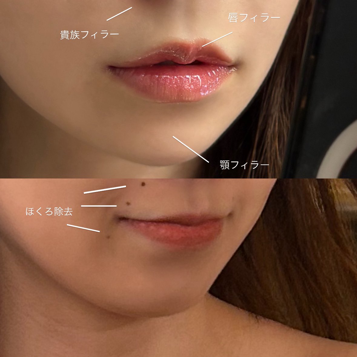 ナナティーナページ ナナ (@__o0nan) / Posts / X