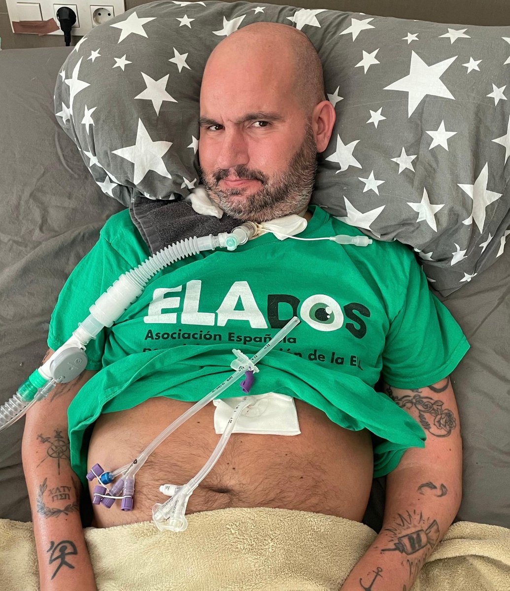 Jordi Sabaté Pons (@pons_sabate) on Twitter photo HOY ME PODRÍA HABER MUERTO, RUEGO MÁXIMA DIFUSIÓN 🙏
Hola <a href="/icscat/">ICS. Generalitat</a>, no sé por cual razón habéis cambiado el proveedor de sondas gástricas al <a href="/vallhebron/">Vall d'Hebron</a>, pero ese cambio, hoy me hubiera podido costar la vida, al no entrar de ninguna forma la sonda por el estoma.
Llevaba muchos HOY ME PODRÍA HABER MUERTO, RUEGO MÁXIMA DIFUSIÓN 🙏
Hola <a href="/icscat/">ICS. Generalitat</a>, no sé por cual razón habéis cambiado el proveedor de sondas gástricas al <a href="/vallhebron/">Vall d'Hebron</a>, pero ese cambio, hoy me hubiera podido costar la vida, al no entrar de ninguna forma la sonda por el estoma.
Llevaba muchos