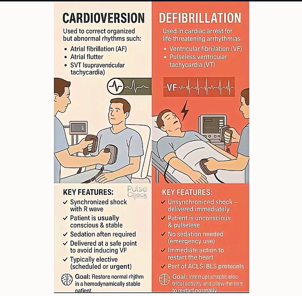 HiraaliCardio's tweet image. The main difference is timing and coordination with the heart’s electrical cycle: cardioversion is planned and syncs with the heartbeat, while defibrillation is an urgent, unsynchronized shock because the heart is in chaotic fibrillation.

#cardioversion
@heartvisual