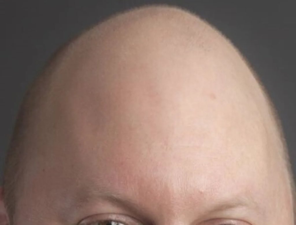 <a href="/coverd/">Coverd</a> Everyone asks me
Simp!
Why do you Depsise the Great Egg?

Look at his fruits,
I respond

Look at the companies
He backs