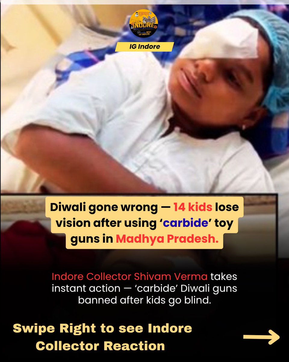 IgIndore's tweet photo. 🚨 Madhya Pradesh Shock:
14 children lose eyesight, 120+ hospitalised after using deadly ‘carbide’ Diwali cracker guns.

After the news went viral, Indore Collector Shivam Verma imposed an immediate ban on these explosive toys across MP.

#Indore #Bhopal #MadhyaPradesh https://t.co/YIG9HKOEbd