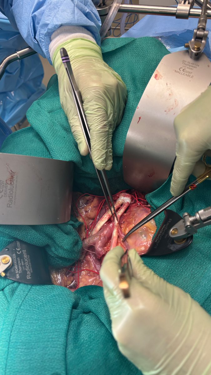 Alan Lumsden, MD, CV Chairman/Director tweet media