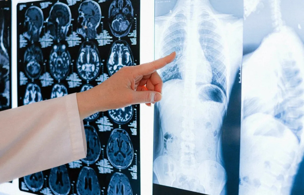 📌La Brújula de Canarias
📅 Viernes | 24 de octubre | 2025
🗣️ <a href="/oscarmartinTF/">Oscar Martín</a>
⚽️ Deportes con <a href="/AleixValero/">Aleix Valero 🇮🇨 🏴󠁧󠁢󠁳󠁣󠁴󠁿</a> 
🩺 Entrevista a <a href="/delvysra/">Delvys Rodriguez Abreu</a>, director de la Fundación Canaria contra el Cáncer de Pulmón
ondacero.es/podcast/emisor…