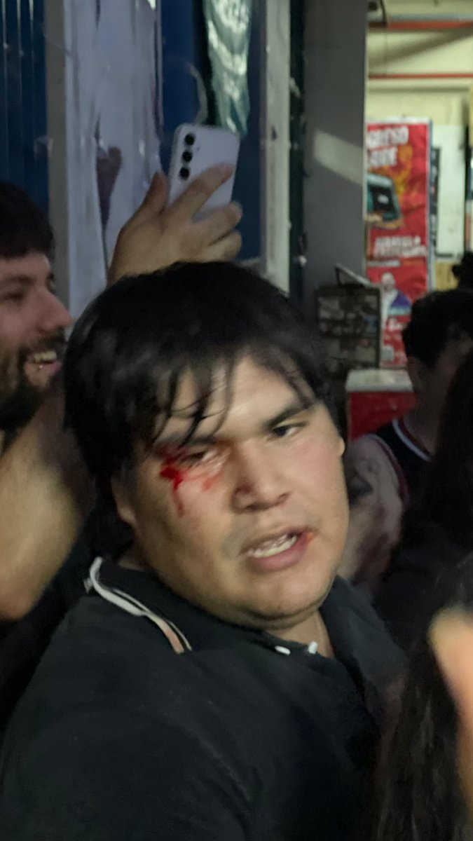 DENUNCIAMOS A LA BUROCRACIA DEL FULF POR LA SALVAJE AGRESION A UN ESTUDIANTE LABURANTE DE ARTEINSURRECCION

Hacemos responsables a las autoridades por estas bárbaras agresiones hacia todos nuestros compañeros por parte del FULF (La Cámpora - Patria Grande)