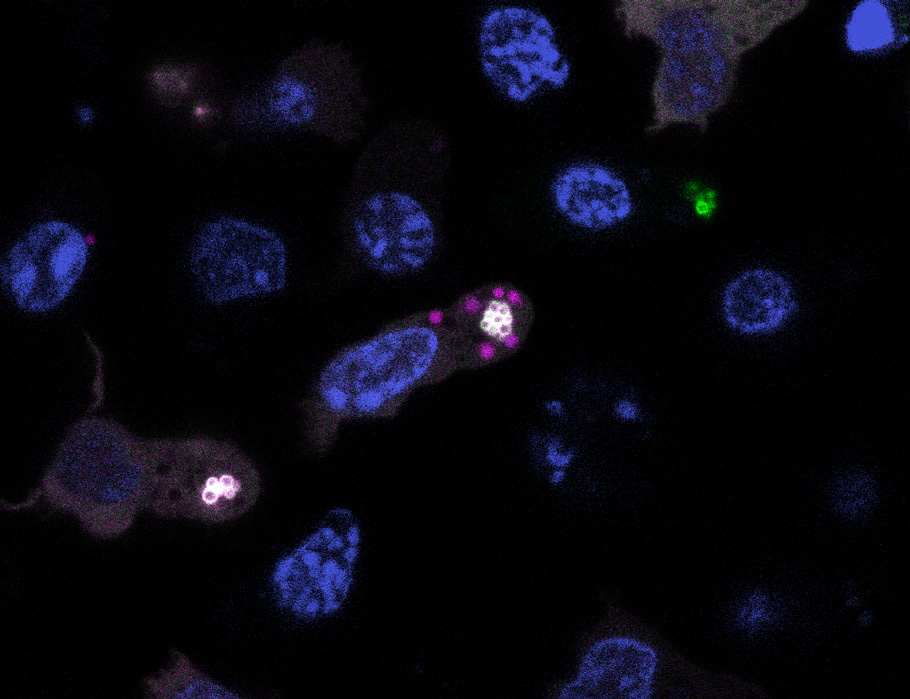 #TH2 cells take up fatty acids that build up in the lungs during chronic airway inflammation and break them down via microlipophagy, which triggers ST2 expression and drives #allergic disease in mice. 

Learn more in Science #Immunology: scim.ag/4nqgY8E