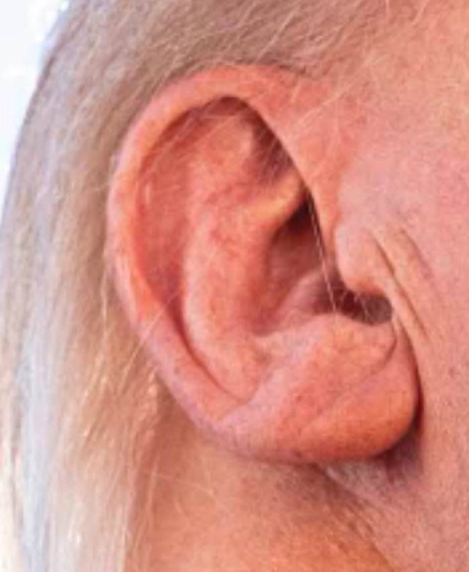 <a href="/ClaudetteGGibs1/">Nurses Against Dick Pics. 🪷🇺🇦</a> Yes. Nary a scratch