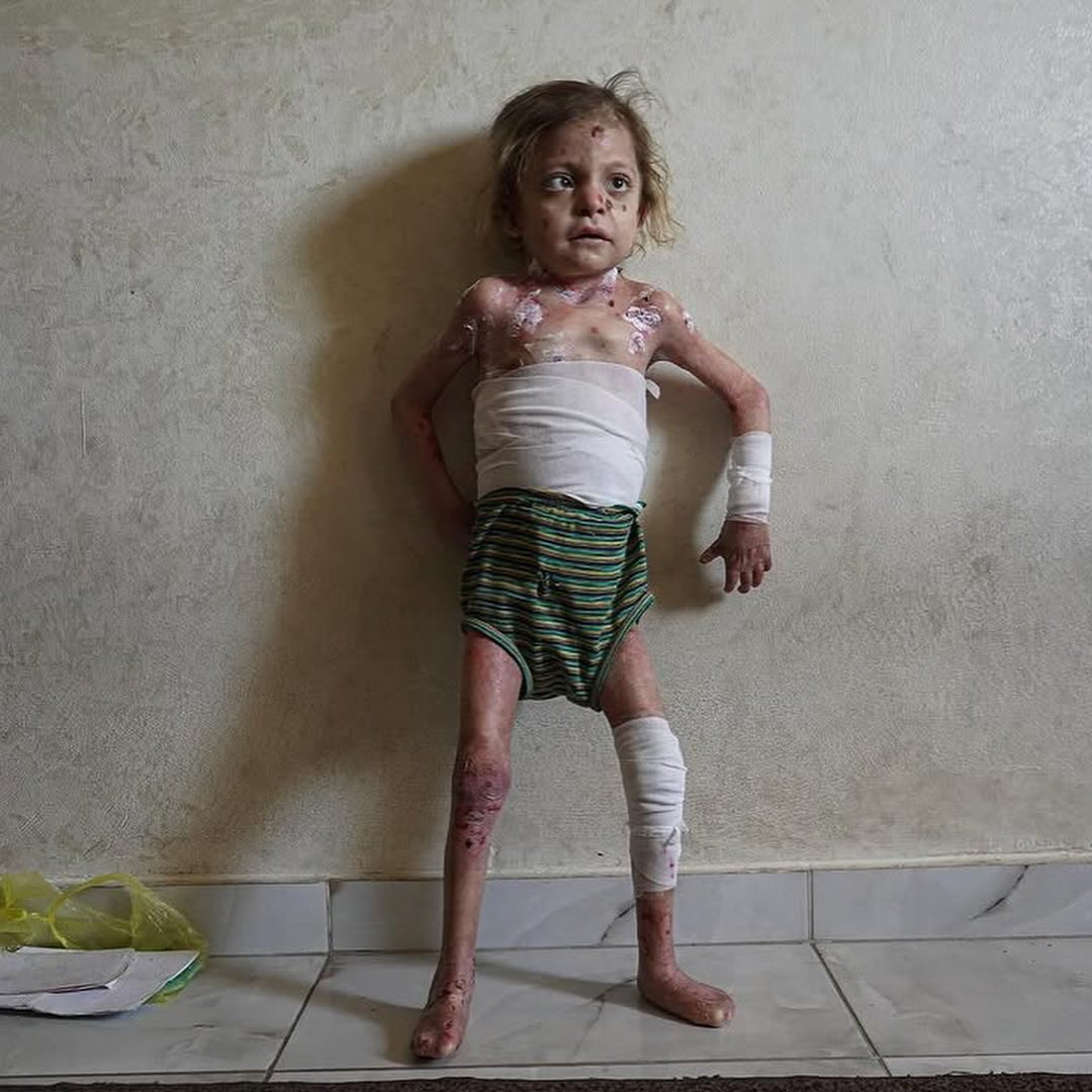 Eğer kaydırıyorsanız, LÜTFEN yoruma nokta bırakır mısınız.?

Ateşkes Nerede?
#WhereIsTheCeasefire