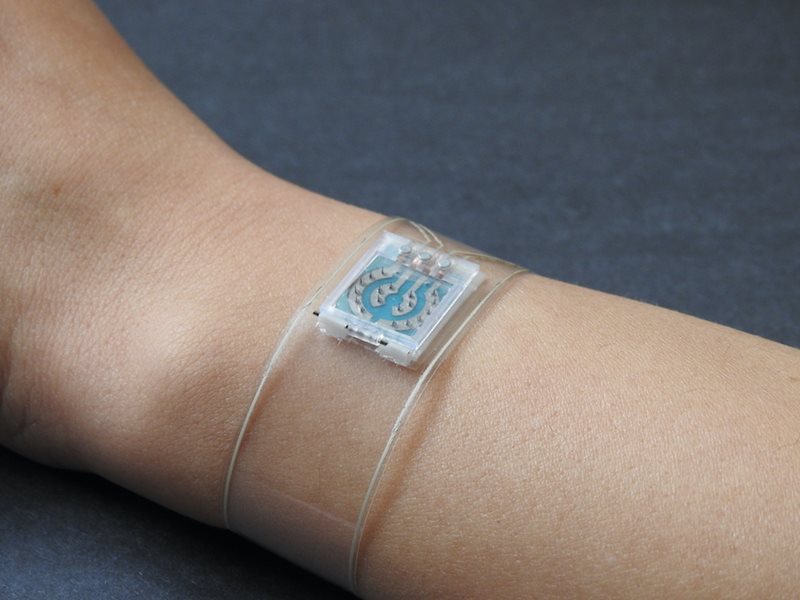 ASMEdotorg's tweet image. At the @UCSanDiego, engineers are reimagining diabetes monitoring through a wearable wristband that painlessly tracks glucose and cardiovascular health using a replaceable microneedle array: asme.org/topics-resourc…