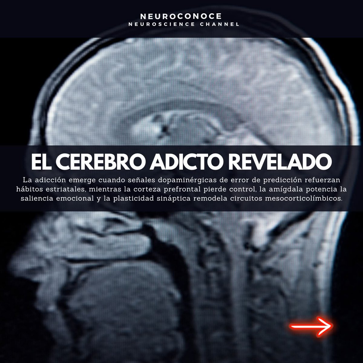 RebolledaGil's tweet photo. La adicción no es simplemente “falta de voluntad”; es una reorganización progresiva de circuitos mesocorticolímbicos que priorizan la obtención de la sustancia o conducta. En el inicio, las descargas dopaminérgicas del área tegmental ventral (VTA) 👇 https://t.co/YCgQVK7Dop