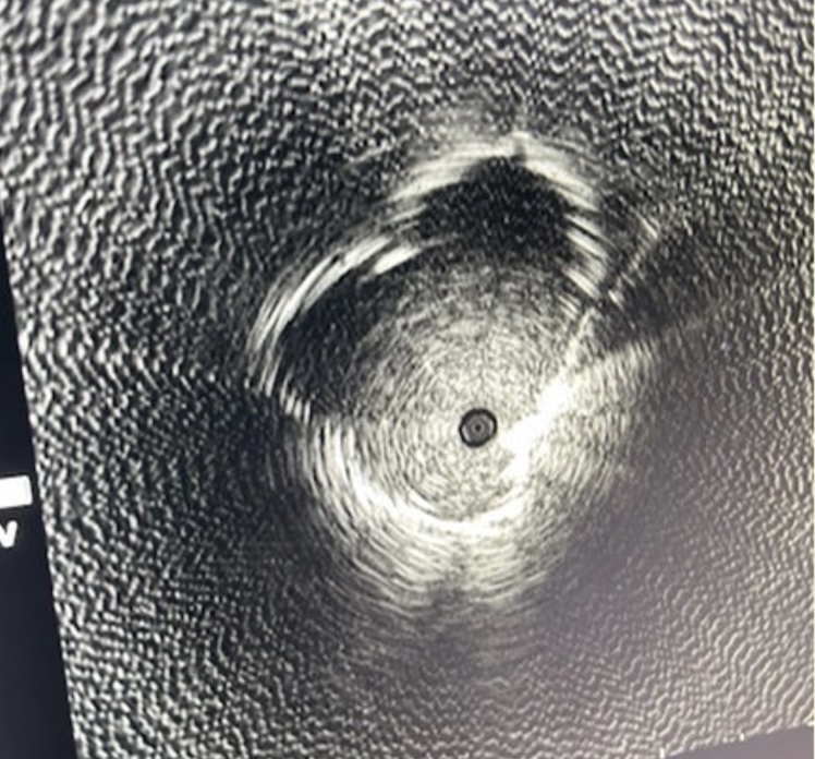 GS_Bronch tweet media