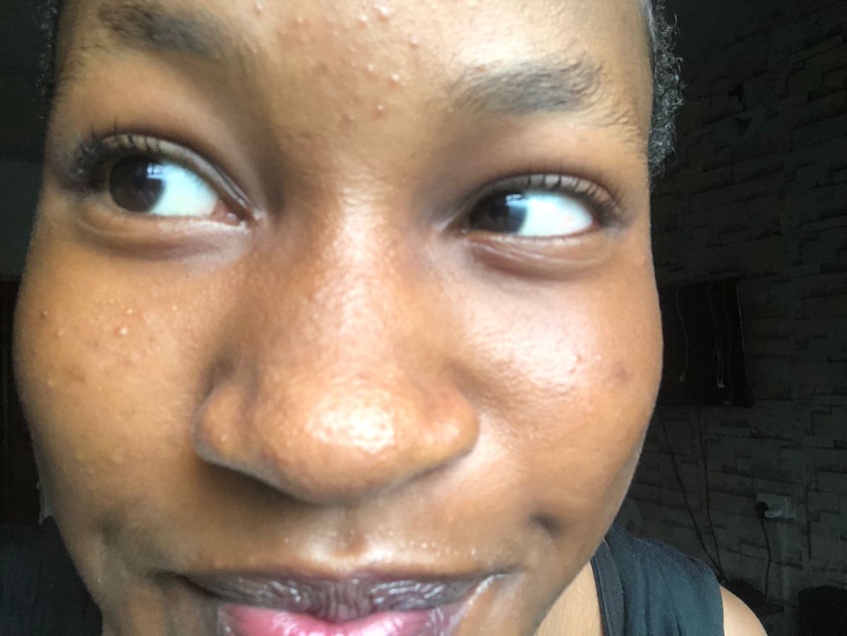 snaxnshii's tweet image. I didn’t like social media because it looked simple.

​I saw my mom&apos;s business struggling. Her page wasn&apos;t interesting, and she was losing customers and sales. 

I knew I didn&apos;t want her to lose her only source of income 

​So, I started learning about social media management.