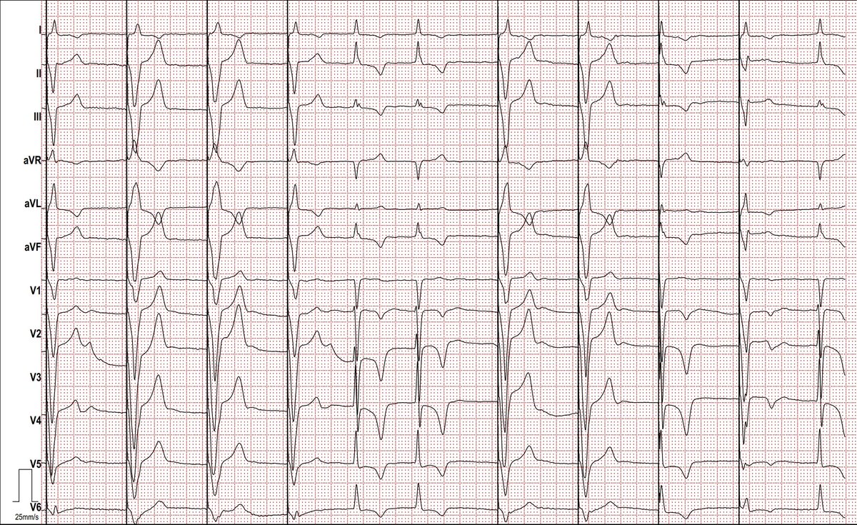 Dr. Andreas Roeschl tweet media