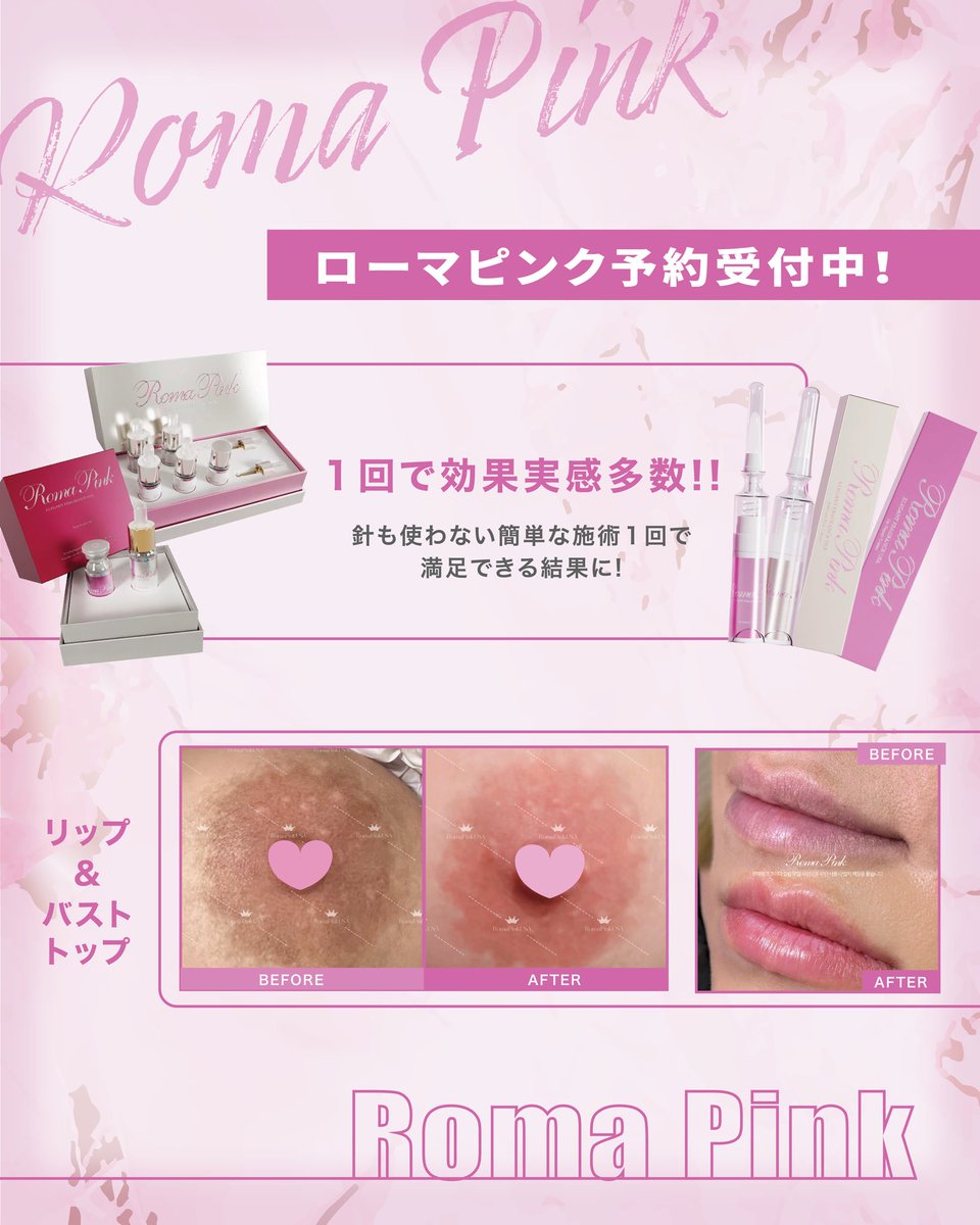 romapink