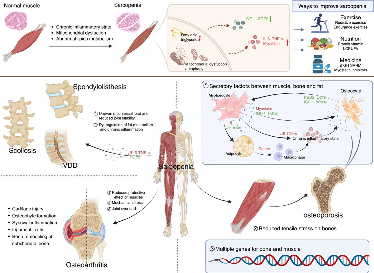 Research progress on sarcopenia in the musculoskeletal system
nature.com/articles/s4141…