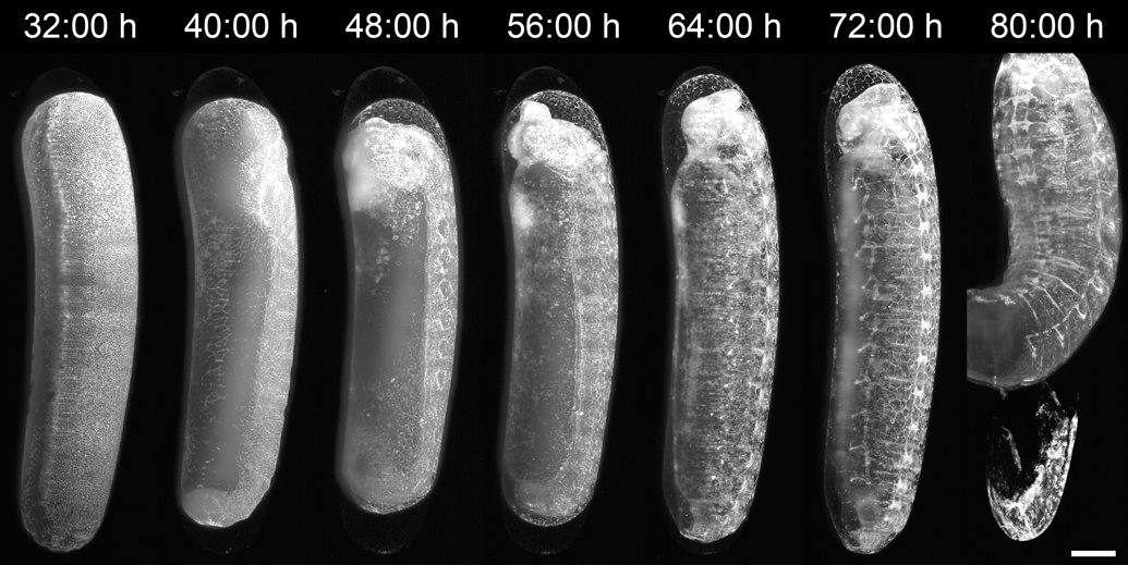 BiologyOpen's tweet image. With mRNA-based labelling and light sheet fluorescence imaging in Perfluorodecalin, Oksana Netschitailo and colleagues reveal the dynamics of extra-embryonic membrane formation in honeybee embryos. doi.org/10.1242/bio.06…

#LiveImaging #Insects #Morphogenesis