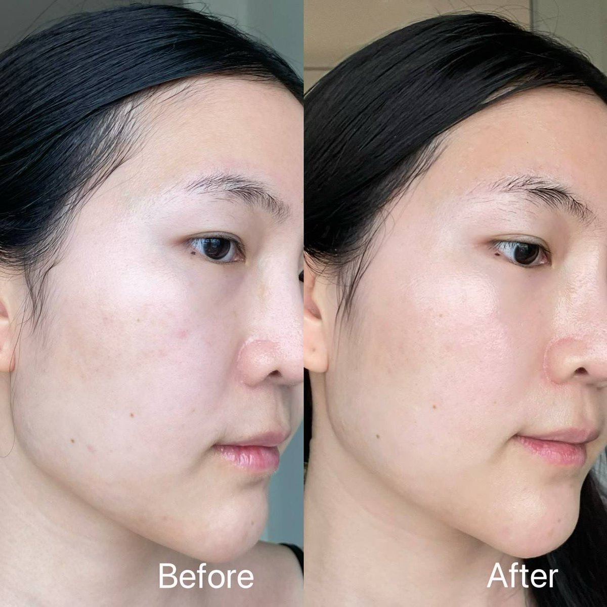 เซรั่มขวดนี้ครบจบจริง✨ Vichy Liftactiv collagen 16 serum ขวดแดงนี้แหละที่คนตามหากันน❤️ น้องช่วยบูสต์ผิวด้วยคอลลาเจนจัดเต็มอยู่ในขวดนี้ ยิ่งอายุมากขึ้นควรใช้เลยเพราะช่วยเรื่องริ้วรอย รู้สึกว่าผิวละเอียดขึ้น เสริมเกราะป้องกันผิว เติมความชุ่มชื้น ดีเกินราคาอะ