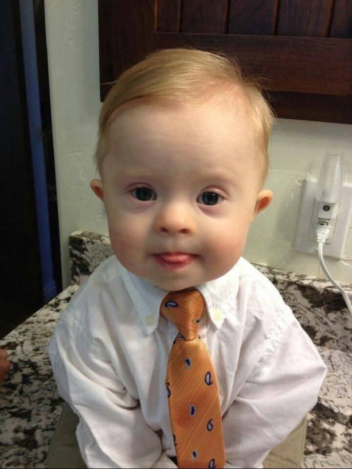 emilysketcher's tweet image. He was Born With Down Syndrome 😔 
Who Else Thinks He's Handsome ❤️?