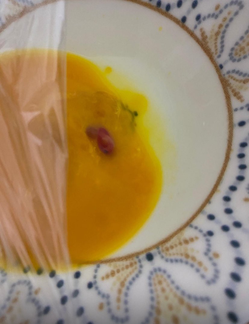 MİDEM KALKTI RESMEN GÖZÜ VAR HAŞLASAM BÖYLE YİCEKTİM YENİ TRAVMA HOSGELDİN