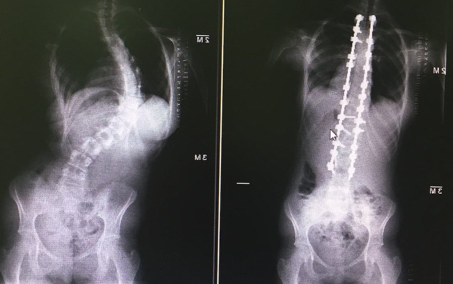 د. نبيل العساف، إستشاري جراحة عظام وعمود فقري tweet media