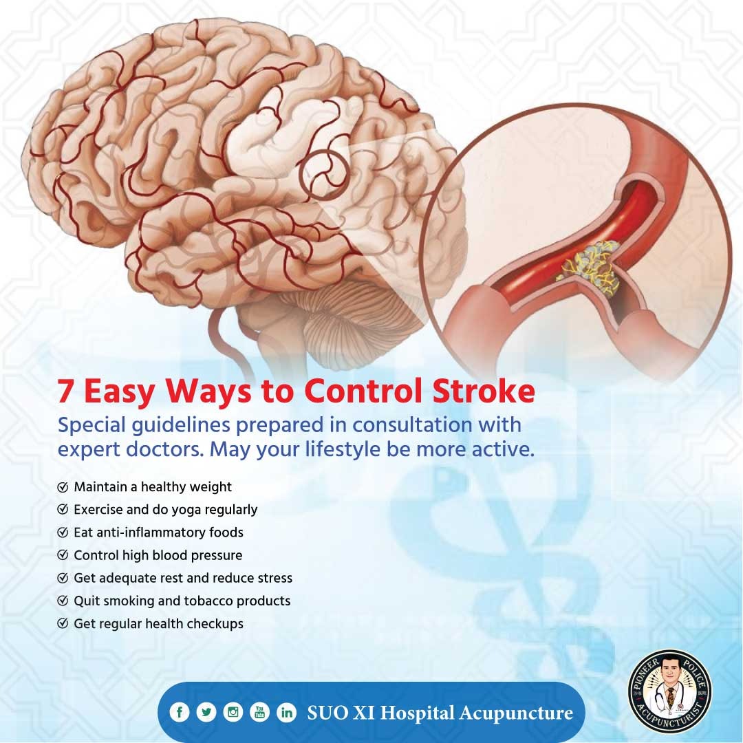 DrSMShahidulIs1's tweet image. 7 Easy Ways to Control Stroke!
Special guidelines prepared in consultation with expert doctors. May your lifestyle be more active... 
#strokerecovery #stroke #StrokeAwareness #suoxi #drsmshahidulislam