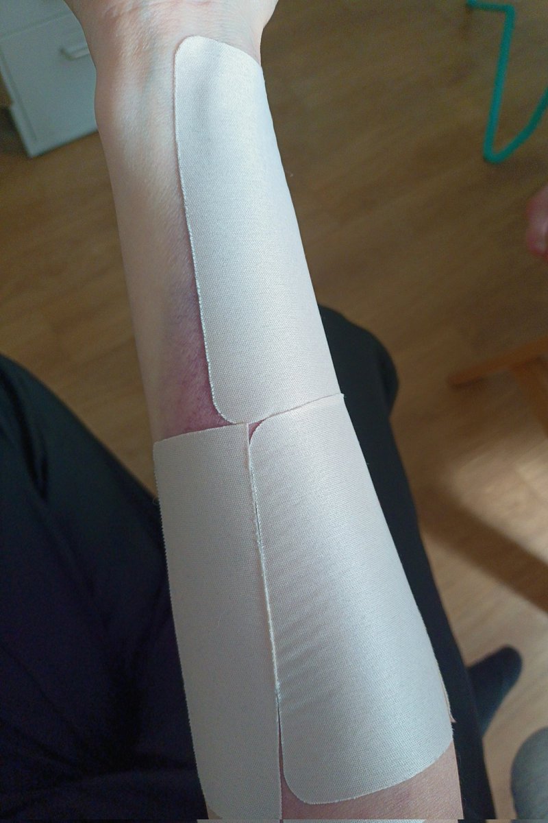 Byabyabb's tweet image. 파스 교체하려고 뗐더니 못붙인 곳 멍만 안빠진거 너무 신기하다 와웅..