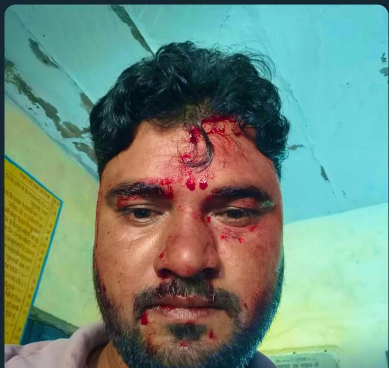 बुंदी में पशुपरिचर सुश्री पिंकी मीणा व उसके परिवारजनो द्वारा पशुधन निरीक्षक श्री शिवराज मीणा जी के साथ मारपीट की घटना बहुत ही निंदनीय हैं ।
90% पशु परिचर संस्थाओं में कोई भी काम नहीं कर रहे ।
प्रशासन को ऐसे कर्मचारियों पर सख्त कार्यवाही करना चाहिए ।
<a href="/JoraramKumawat/">Joraram Kumawat</a> <a href="/RajCMO/">CMO Rajasthan</a>